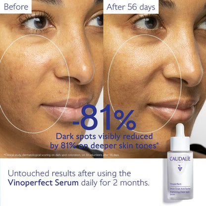 Caudalie Vinoperfect Brightening Dark Spot Serum (30ml)